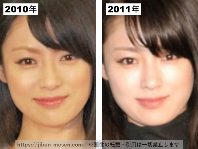 深田恭子の整形疑惑検証2010-2011の画像