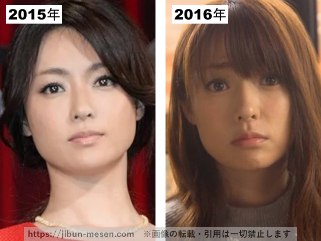深田恭子の整形疑惑検証2015-2016の画像