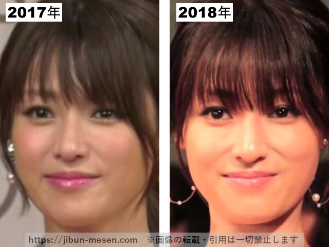 深田恭子の整形疑惑検証2017-2018の画像