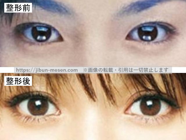 深田恭子の目の整形前と整形後の比較の画像