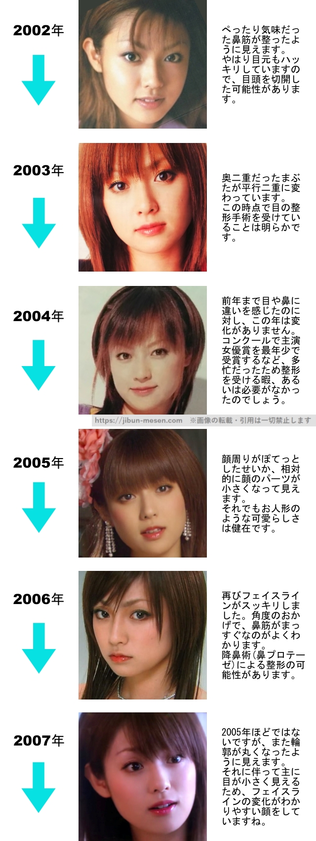 深田恭子の整形検証2002年〜2007年の画像