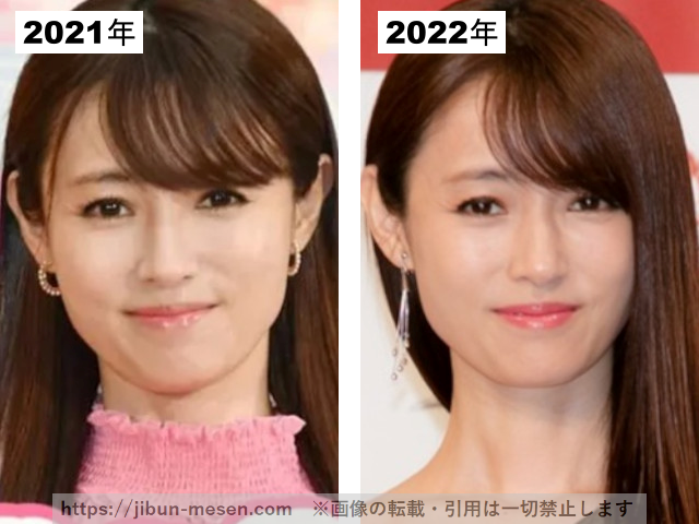 深田恭子の整形疑惑検証2021-2022の画像