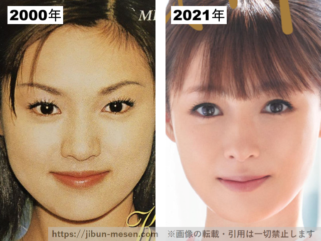 深田恭子のフェイスラインの整形疑惑検証2000-2021の画像