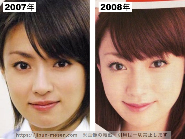 深田恭子の整形疑惑検証2007-2008の画像