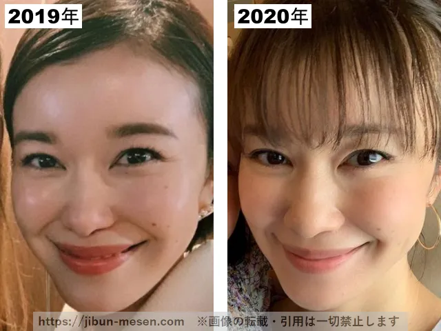 つづりさの整形疑惑調査2019-2020