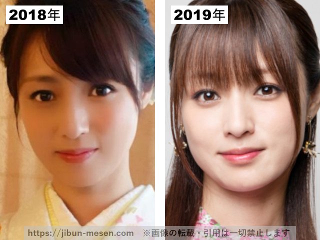 深田恭子の整形疑惑検証2018-2019の画像