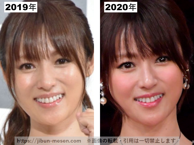 深田恭子の整形疑惑検証2019-2020の画像