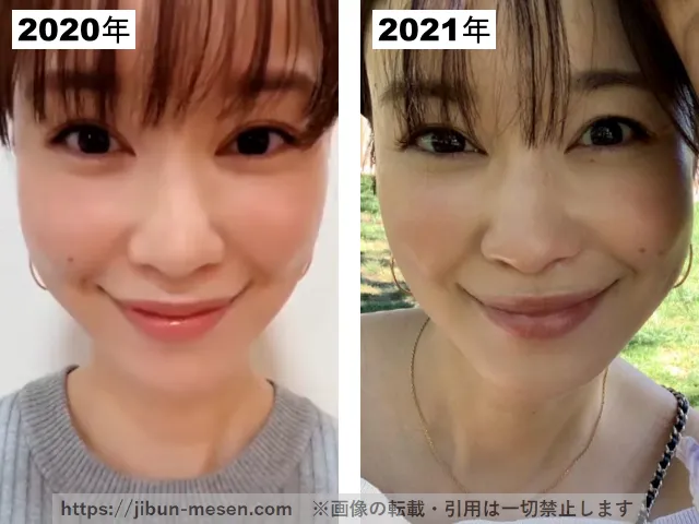 つづりさの整形疑惑調査2020-2021