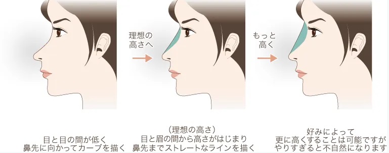ヒアルロン酸注入の理想値の画像