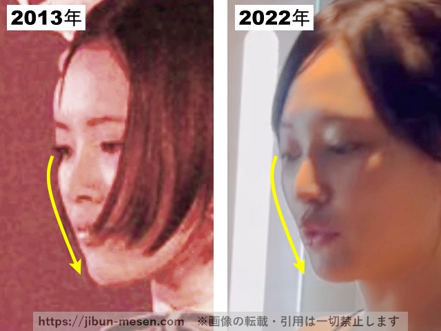兒玉遥の顎の整形検証2013年〜2022年の画像