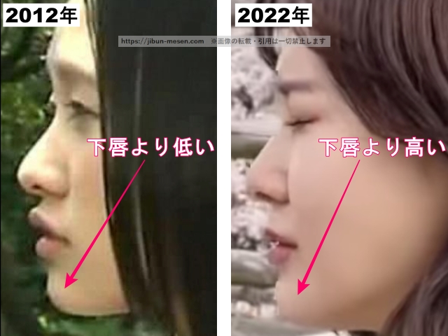 2012年 下唇より低い2022年 下唇より高い