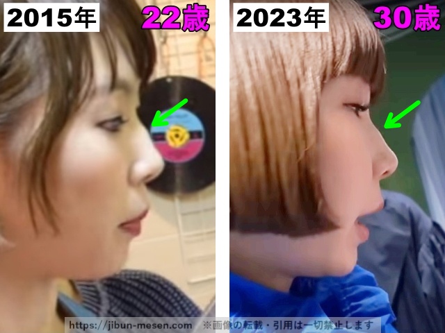 あさぎーにょの鼻の整形検証2015年〜2023年の画像