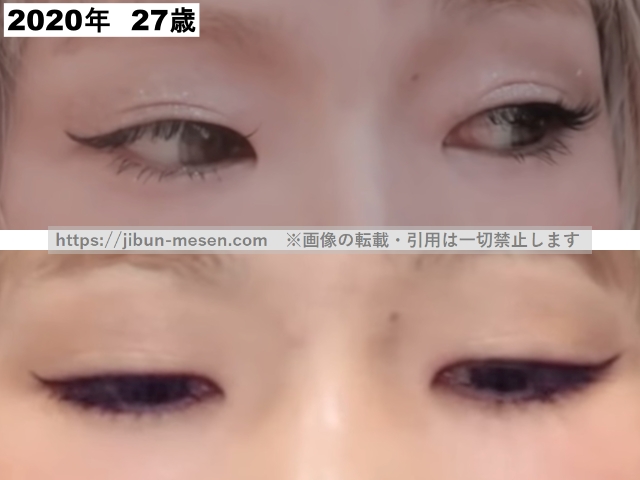 あさぎーにょの二重まぶた2020年の画像