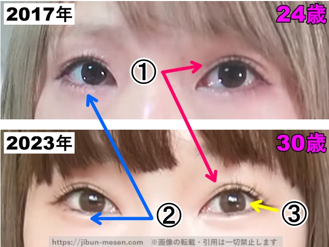 あさぎーにょの目の整形検証2017年〜2023年(拡大)の画像