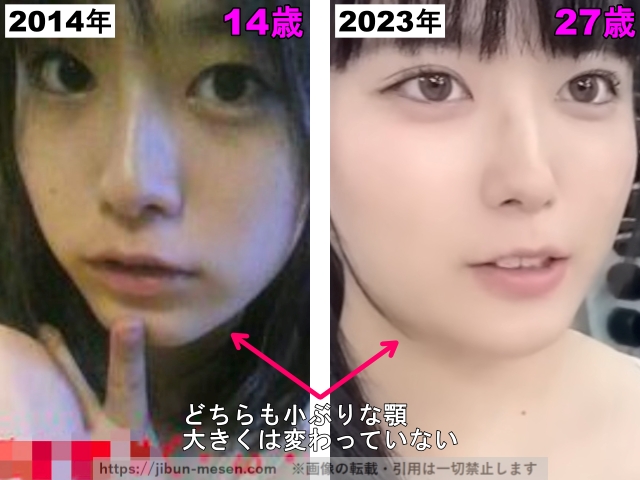 2014年14歳　2023年27歳どちらも小ぶりな顎　大きくは変わっていない