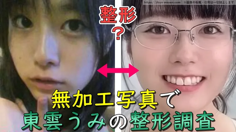 無加工写真で東雲うみの整形調査