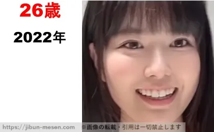 東雲うみの整形検証2022年