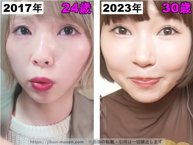 あさぎーにょの目の整形検証2017年〜2023年の画像