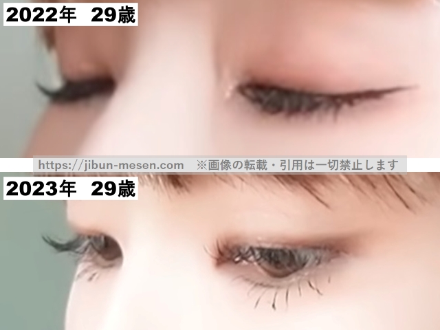 あさぎーにょの二重まぶた2022年~2023年の画像