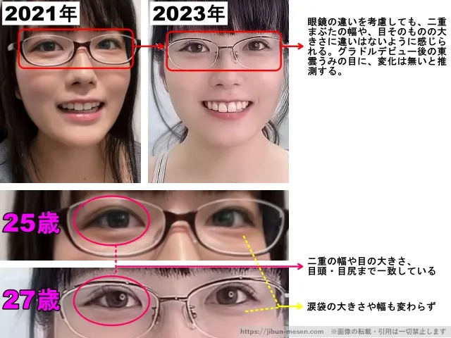 東雲うみの目の整形検証2021年〜2023年