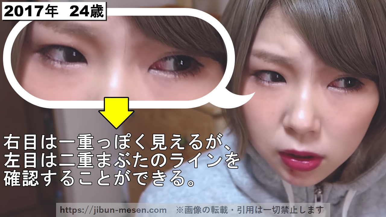 左目は単っぽく見えるが、左目は二重まぶたのラインを確認することができる。