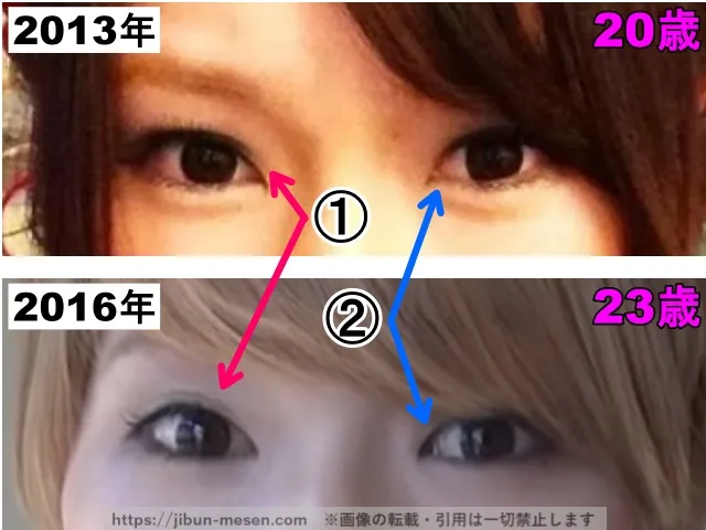 あさぎーにょの目の整形検証2013年〜2016年(拡大)