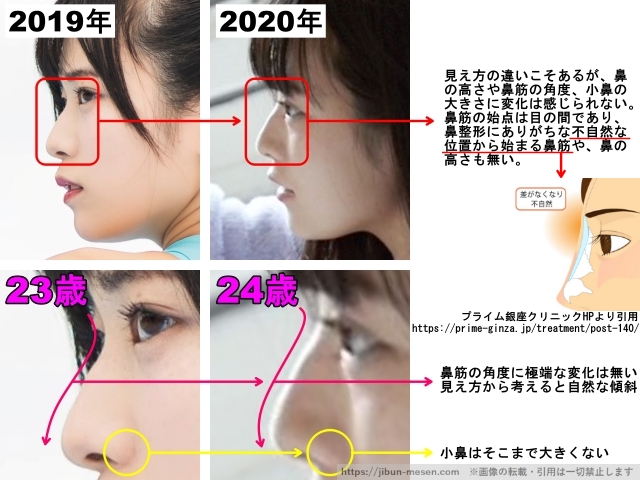 見え方の違いこそあるが、鼻の高さや鼻筋の角度、小鼻の大きさに変化は感じられない。鼻筋の始点は目の間であり、鼻整形にありがちな不自然な位置から始まる鼻筋や、鼻の高さも無い。鼻筋の角度に極端な変化は無い。見え方から考えると自然な傾斜。 小鼻はそこまで大きくない。