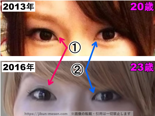 あさぎーにょの目の整形検証2013年〜2016年(拡大)の画像