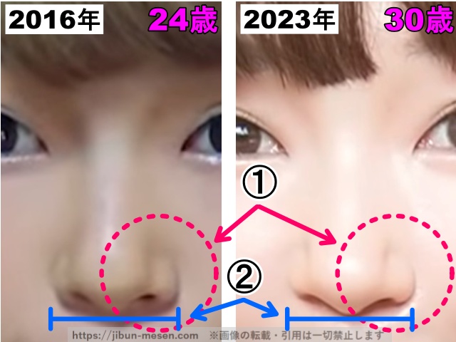 あさぎーにょの鼻の整形検証2016年〜2023年(拡大)の画像