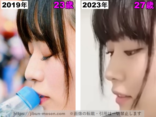 東雲うみの鼻筋の整形検証2019年〜2023年の画像