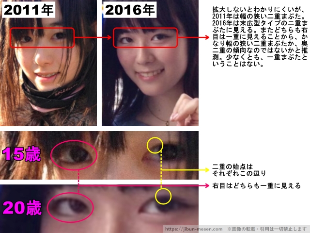 二重の始点はそれぞれこの辺り。右目はどちらも一重に見える。 拡大しないとわかりにくいが、2011年は幅の狭い二重まぶた。2016年は末広型タイプの二重まぶたに見える。またどちらも右目は一重に見えることから、かなり幅の狭い二重まぶたか、奥二重の傾向なのではないかと推測。少なくとも、一重まぶたということはない。