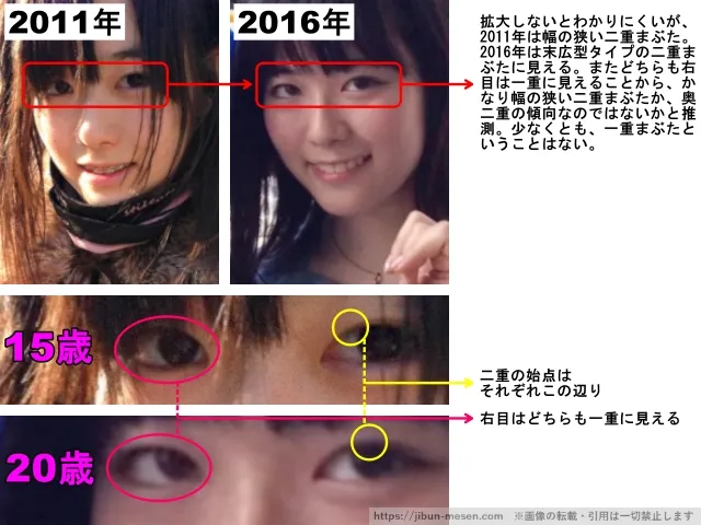 東雲うみの目の整形検証2011年〜2016年