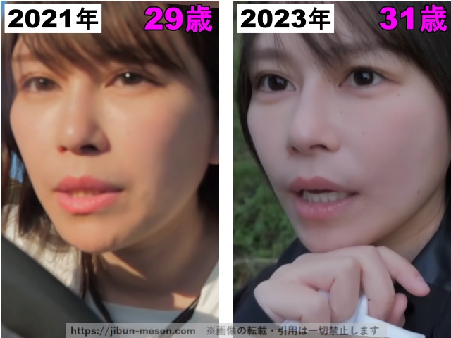 じゅえりーの鼻の整形検証2021年〜2023年の画像