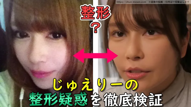 じゅえりーの整形疑惑を徹底検証