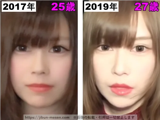 じゅえりーの目の整形検証2017年〜2019年