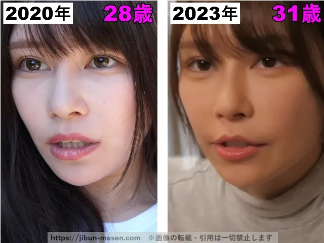 じゅえりーの目の整形検証2020年〜2023年