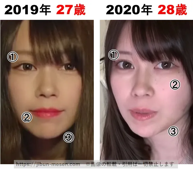 じゅえりーの整形検証2019年〜2020年