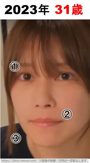 じゅえりーの整形検証2023年