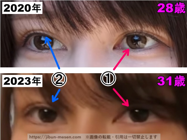 じゅえりーの目の整形検証2020年〜2023年(拡大)の画像