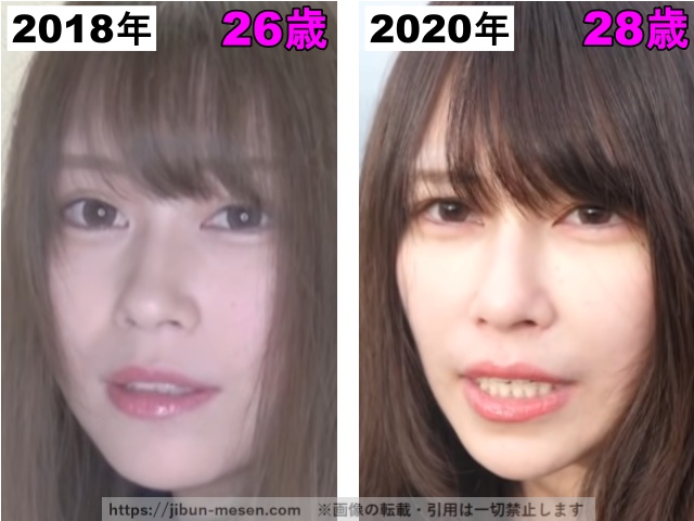 じゅえりーの鼻の整形検証2018年〜2020年の画像