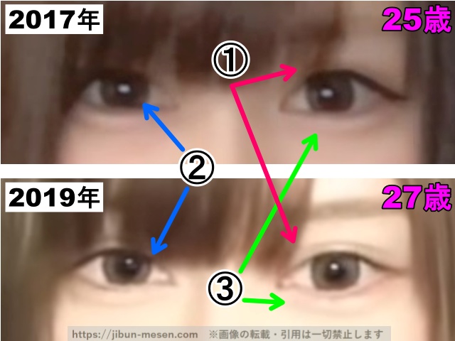 じゅえりーの目の整形検証2017年〜2019年(拡大)の画像