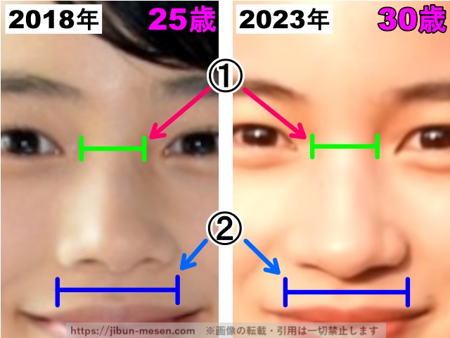 能年玲奈（のん）の鼻の整形検証2018年〜2023年（拡大）の画像