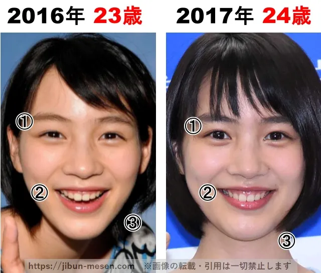 能年玲奈(のん)の整形検証2016年〜2017年