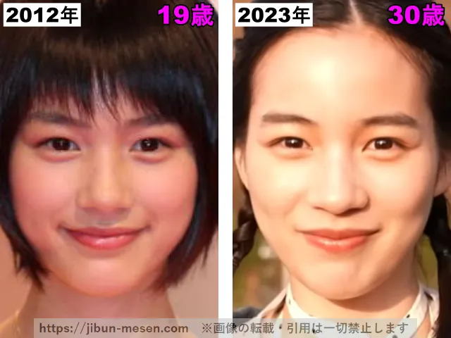 能年玲奈(のん)の口の整形検証2012年〜2023年