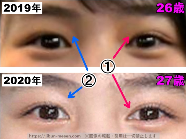 能年玲奈（のん）の目の整形検証2019年〜2020年（拡大）の画像