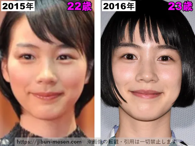 能年玲奈(のん)の輪郭の整形検証2015年〜2016年