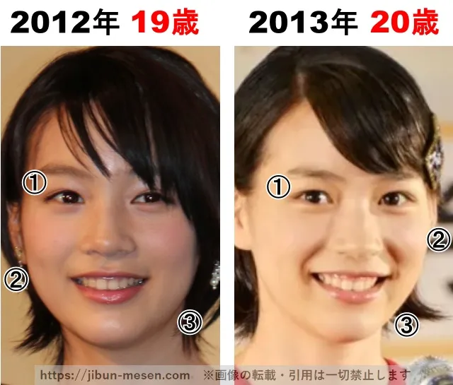 能年玲奈(のん)の整形検証2012年〜2013年