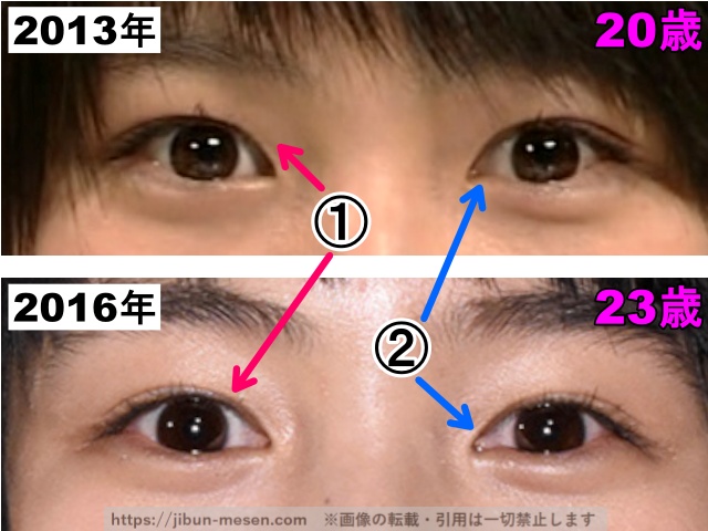 能年玲奈（のん）の目の整形検証2013年〜2016年（拡大）の画像