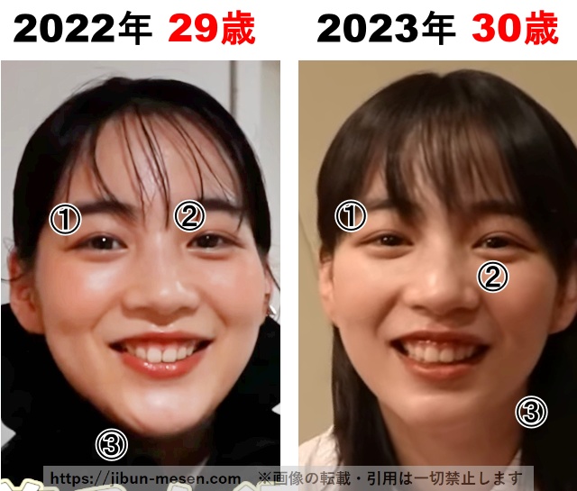 能年玲奈（のん）の整形検証2022年〜2023年の画像