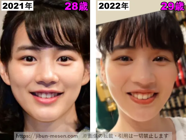 能年玲奈(のん)の輪郭の整形検証2021年〜2022年